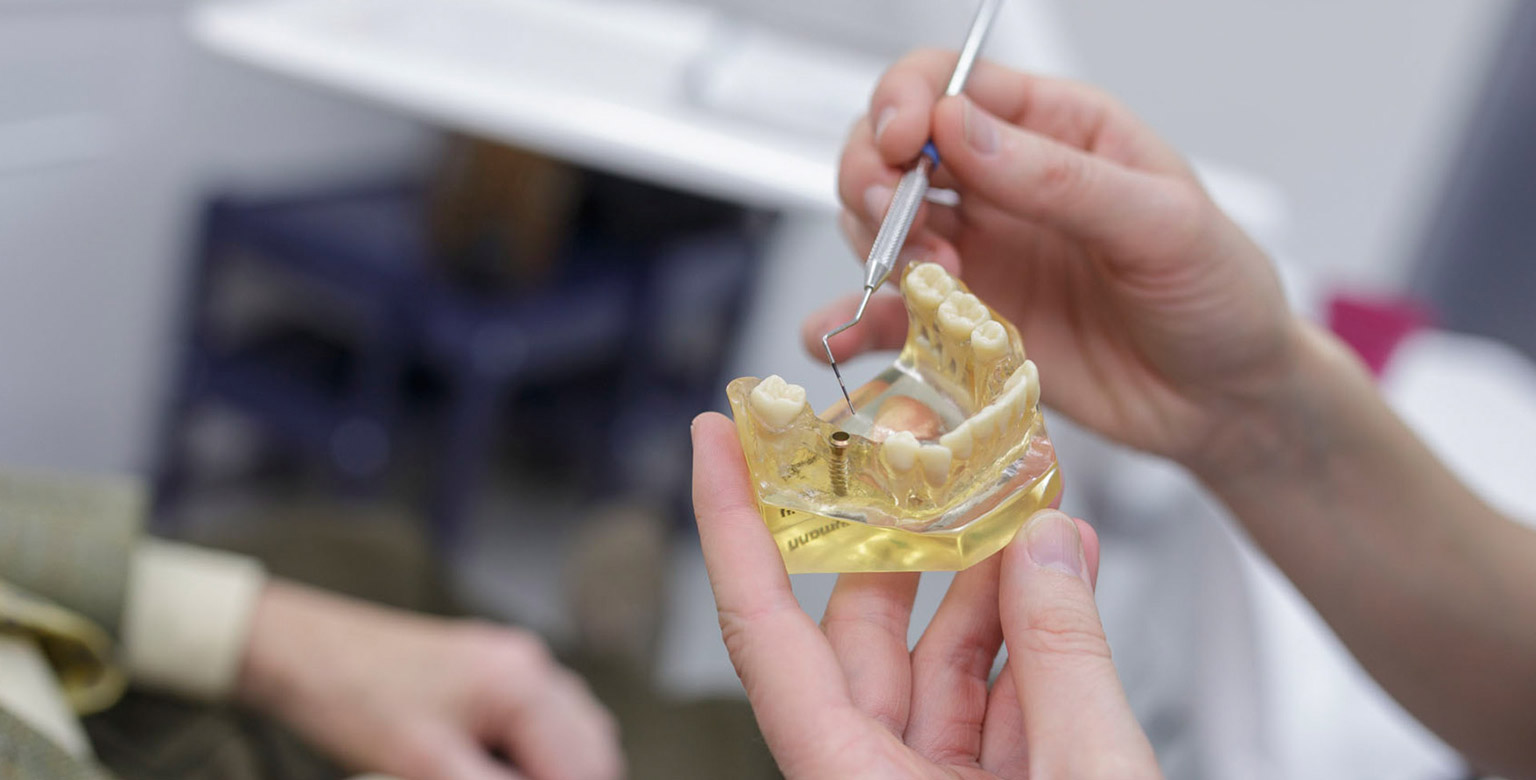 Implantate in Ihrer Zahnarztpraxis Stuttgart